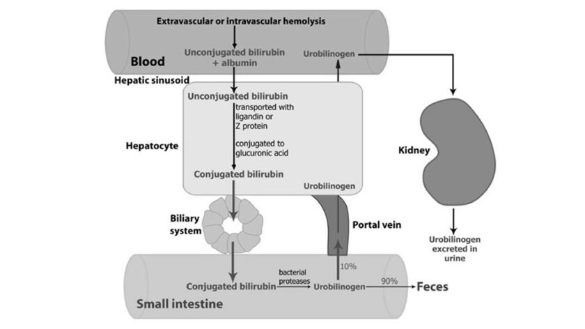Jaundice- An overview